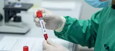 врач проводит тест на COVID-19